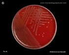 Enterococcus faecalis culture on Petri dish